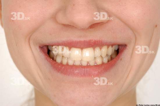 Teeth Woman White Average