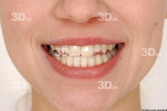 Teeth Woman White Average