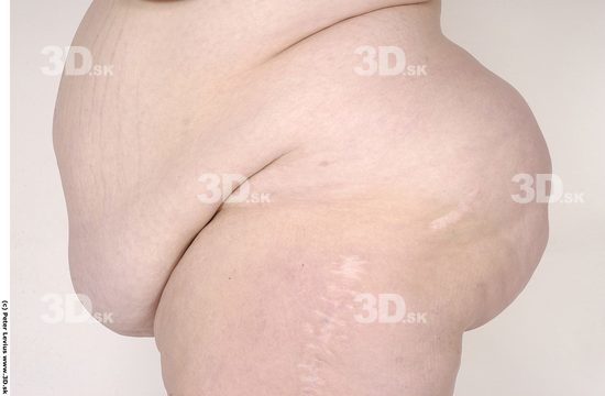 Bottom Woman White Scar Nude Overweight