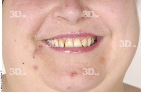 Teeth Emotions Woman White Overweight