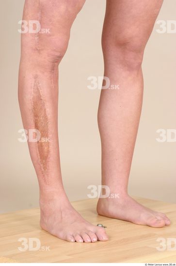 Calf Woman White Scar Nude Average