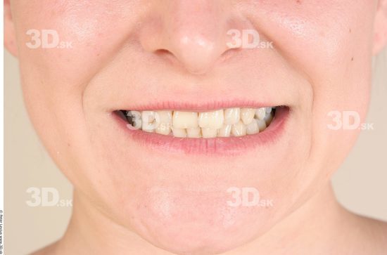 Teeth Woman White Average