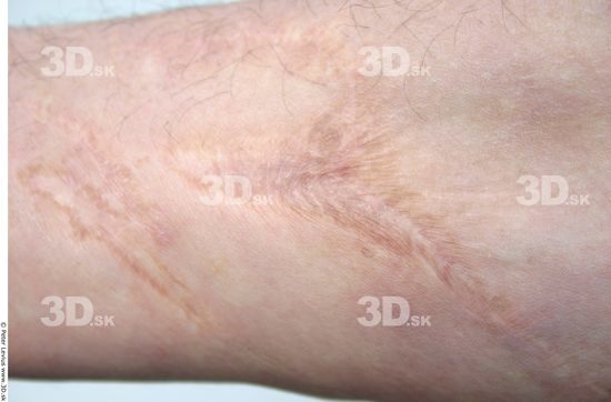 Forearm Man White Scar Nude Average