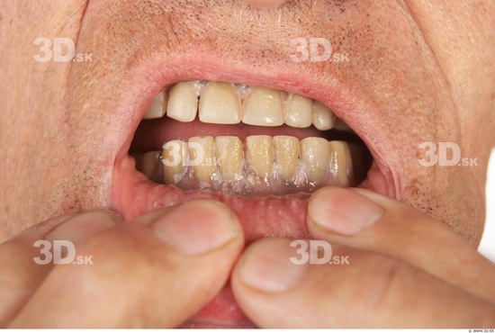 and more Teeth Man White Nude Average