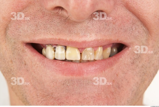 Teeth Man White Nude Average