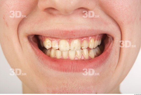 Teeth Woman White Nude Slim