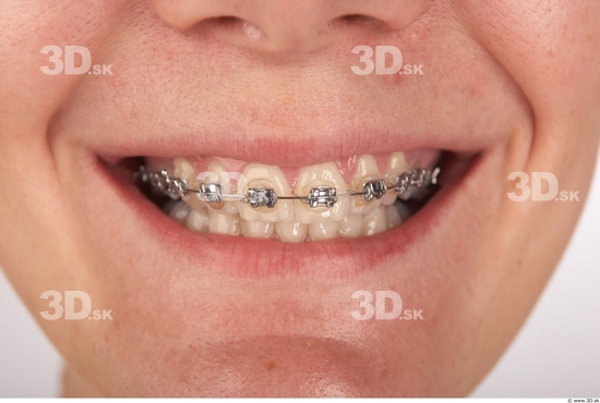 Whole Body Teeth Woman Braces Slim Studio photo references