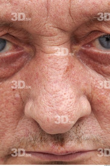 Nose Man White Overweight Wrinkles