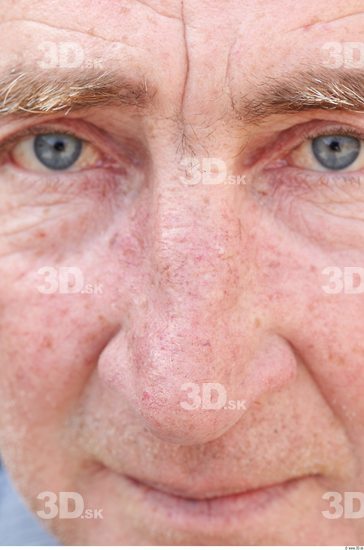 Nose Man White Chubby Wrinkles