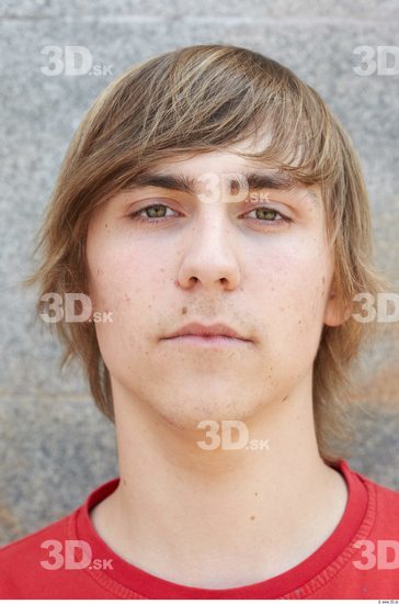 Head Man Birthmarks Athletic Average Street photo references