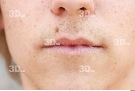 Mouth Head Man Birthmarks Athletic Average Street photo references