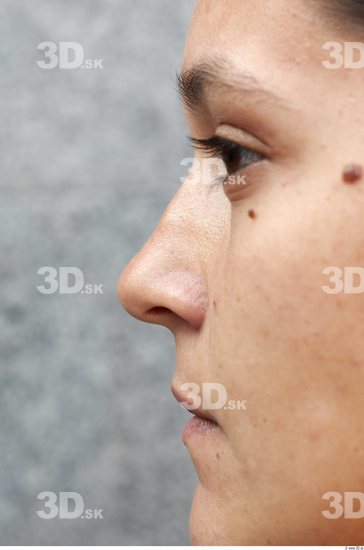 Nose Woman White Birthmarks Average
