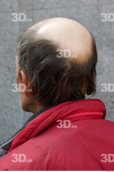 Hair Man White Underweight Bald