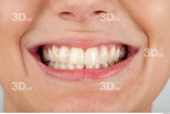 Teeth Slim Studio photo references