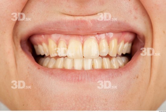 Teeth Slim Studio photo references