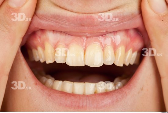 Teeth Slim Studio photo references