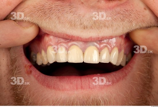 Teeth Man Studio photo references