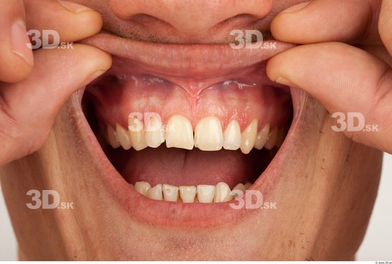 Teeth Athletic Studio photo references