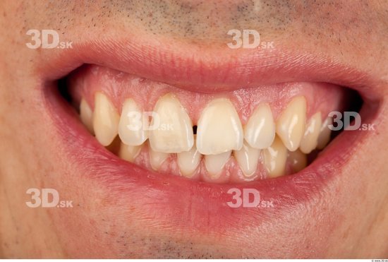 Teeth Man Athletic Studio photo references