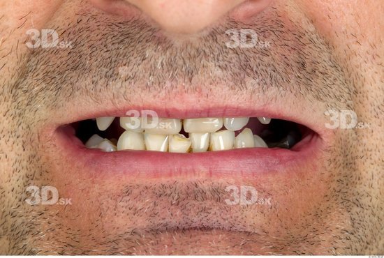 Teeth Man Average Studio photo references