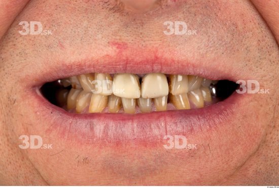 Teeth Man Average Studio photo references