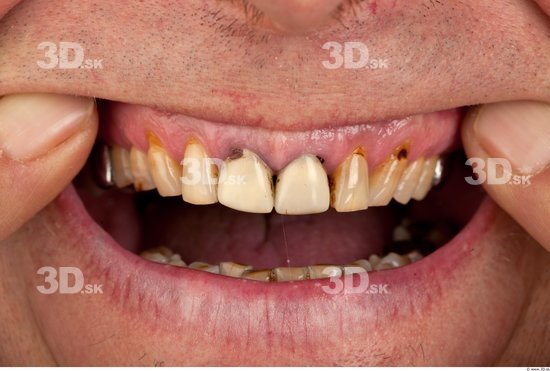 Teeth Man Average Studio photo references