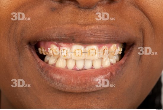 Teeth Woman Studio photo references