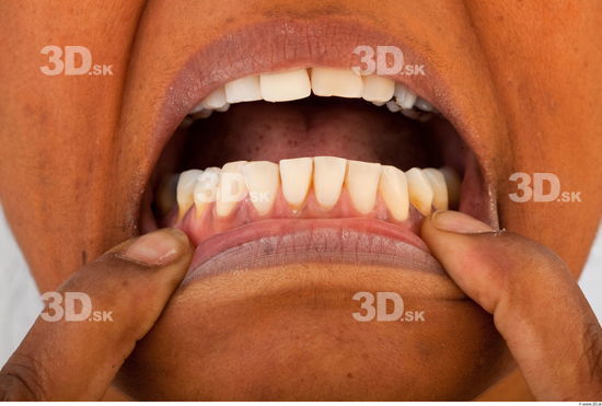 Teeth reference of Cecelia