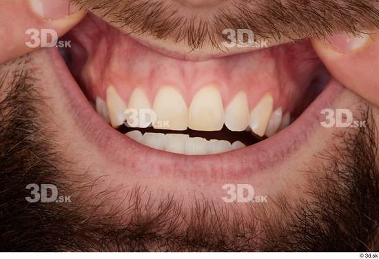 Teeth Man White Slim Studio photo references