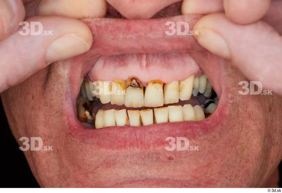 Teeth Man White Average Studio photo references