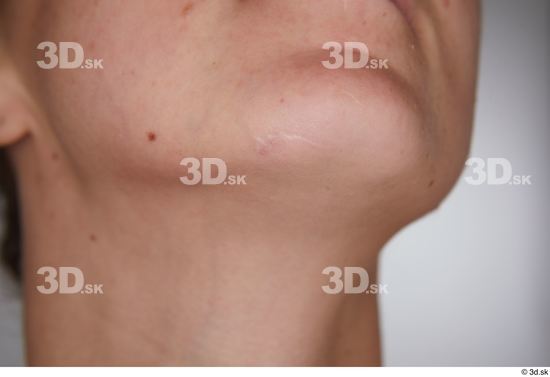 Isabella De Laa chin scar  jpg