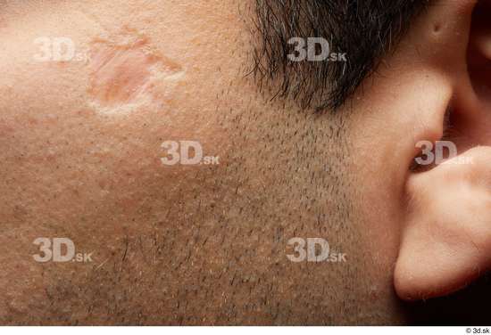 Face Cheek Ear Hair Skin Man Scar Slim Studio photo references