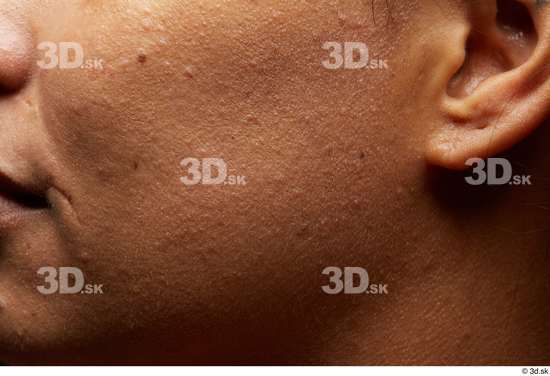 Face Cheek Ear Skin Woman Scar Chubby Studio photo references