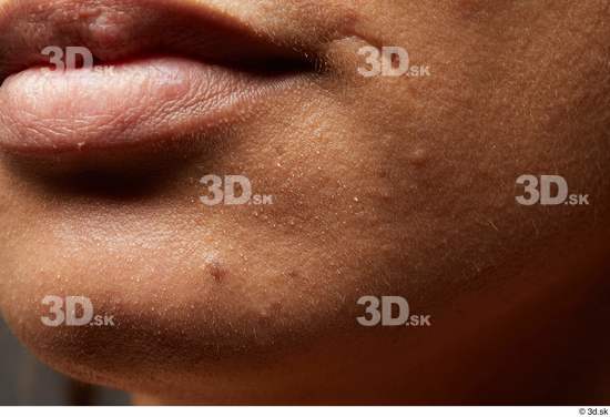 Face Mouth Cheek Skin Woman Scar Chubby Studio photo references