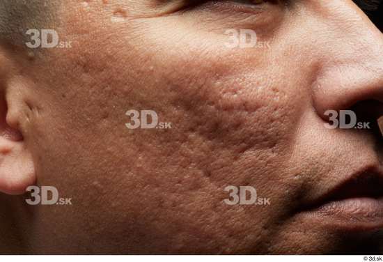 Face Mouth Nose Cheek Skin Man Scar Slim Wrinkles Studio photo references