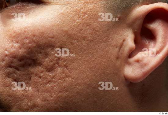 Face Cheek Ear Skin Man Scar Slim Studio photo references