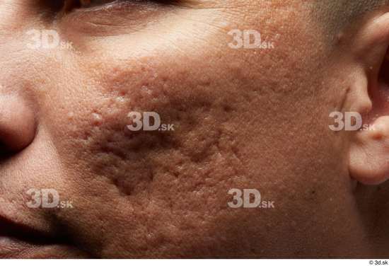 Face Cheek Skin Man Scar Slim Wrinkles Studio photo references