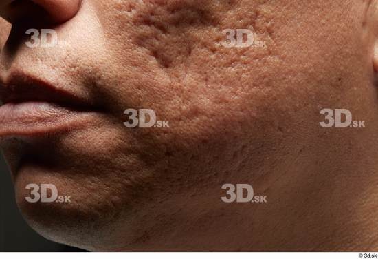 Face Mouth Cheek Skin Man Scar Slim Studio photo references