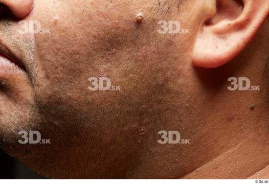 Face Cheek Ear Skin Man Overweight Studio photo references