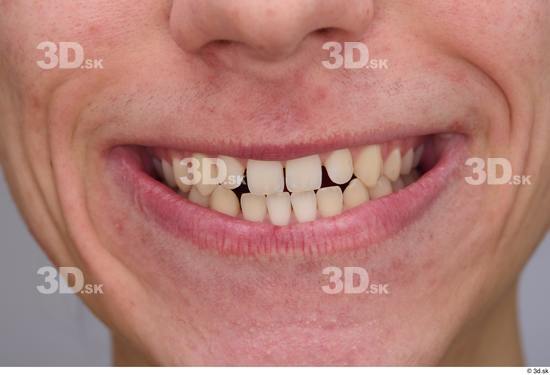 Teeth Man White Slim Studio photo references