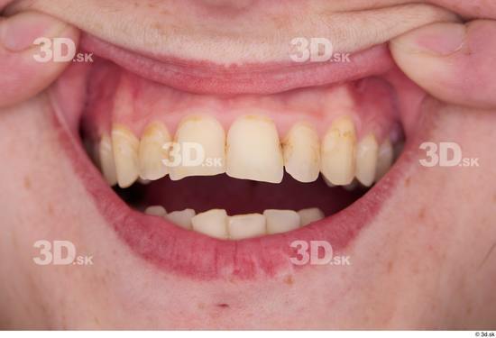 Teeth Woman White Slim Studio photo references