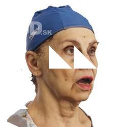 3D head scan of emotions and phonemes - Blanka