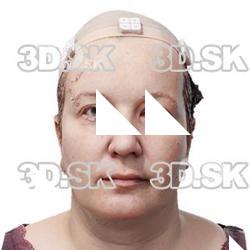 Sara John Raw Head Scan
