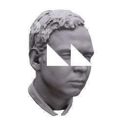 Tadeas Base Scan Head