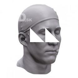 Marek Base Scan Head