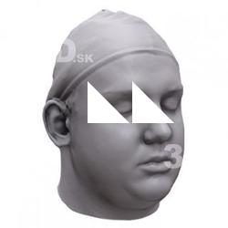 Alexio Base Scan Head