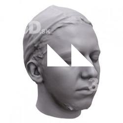 Stephan Base Scan Head