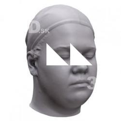Nicol Base Head Scan