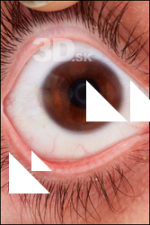 Cody Miles HD Eyes