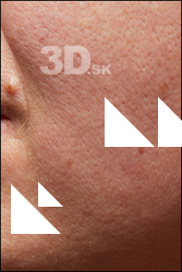  HD Face Skin Charity Sarumpaet 
